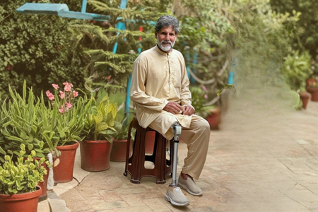 Prosthetic Limbs